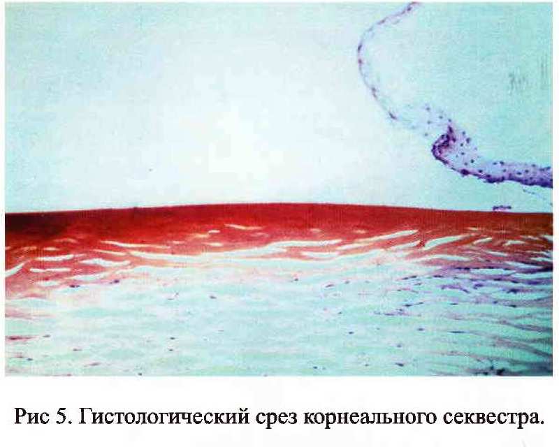 Секвестр на глазу у кошки лечение без операции